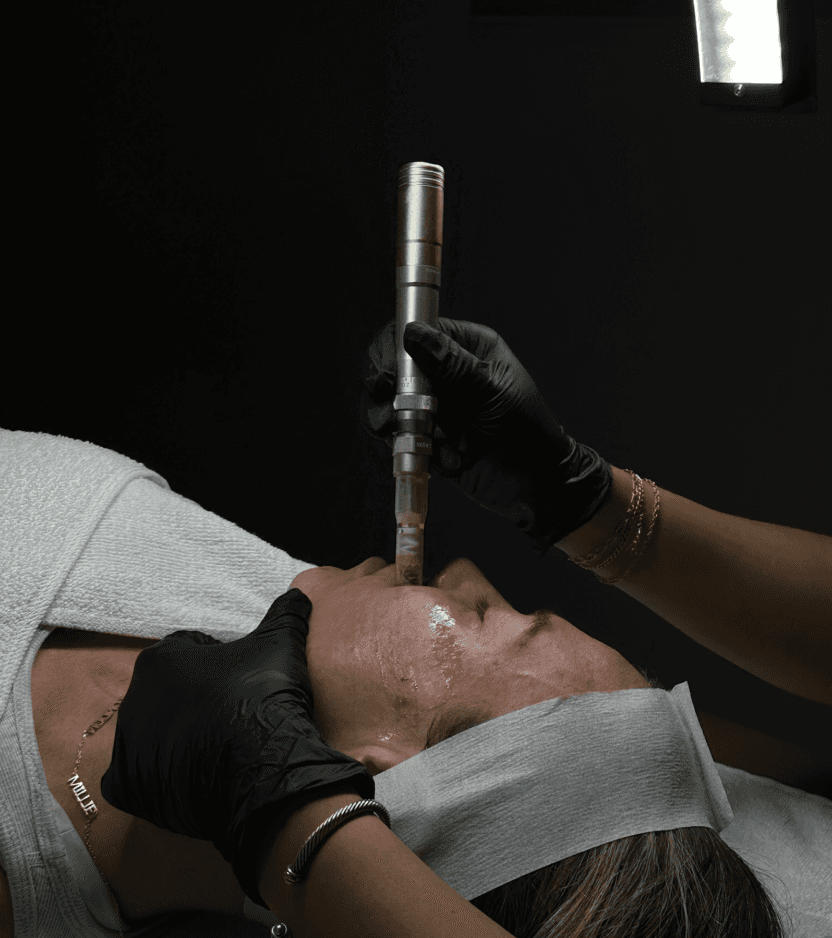 Microneedling Face & Neck